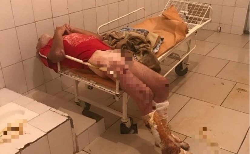 В Новороссийске медики отмыли, одели, накормили бездомного пациента и… получили град упреков