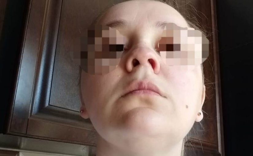 Начинается суд над лжехирургом, которая изуродовала нос жительнице Новороссийска
