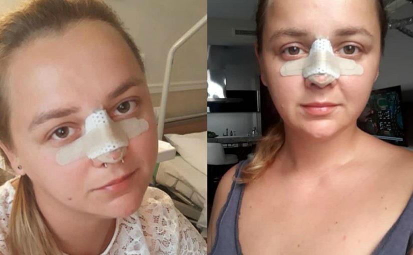 Жена футболиста Мамаева оплатила лечение девушки из Новороссийска, которую изуродовала «Доктор Франкеншетйн»