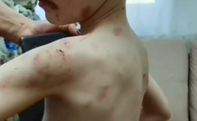 Службы Новороссийска 3 месяца назад узнали об издевательствах над 6-м мальчиком, но не стали его спасать